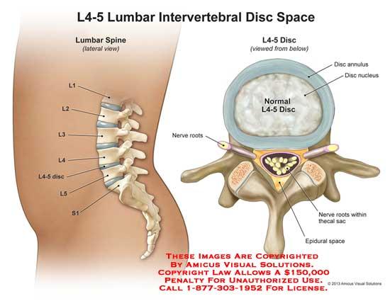4 Anatomical Description What is a bulging disc? Our spine is made up of a chain of bones called the vertebrae.