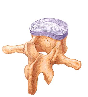 Disc Injury, Lower Back Pain and Sciatica Disc injuries are the most common cause of lower back pain and sciatica, the sharp, shooting pain that radiates from the lower back into the buttock, thigh,