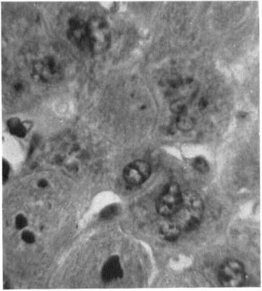 INHIBITION OF MITOSIS BY COLCHICINE 509 At a later period, eighteen to twenty-four hours, these types of figures are still seen, but in addition to these binucleate and trinucleate cells can be seen,