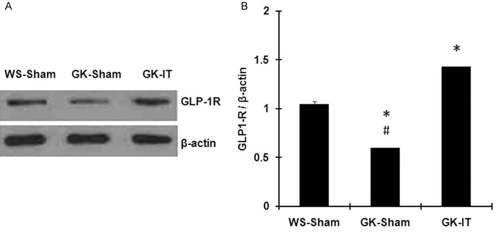 Figure 2. Expression of GLP-1R protein in rats of the three groups. A. Western blot analysis of the expression of GLP- 1R protein.