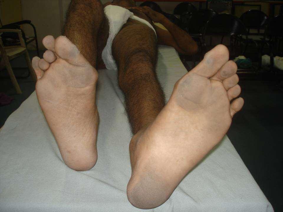 Foot Size