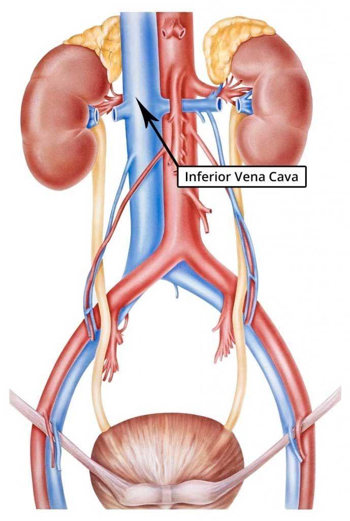 The IVC AP diameter will be at its maximum during expiration and minimum during inspiration. The IVC is formed by the union of the common iliac veins around the level of the umbilicus.
