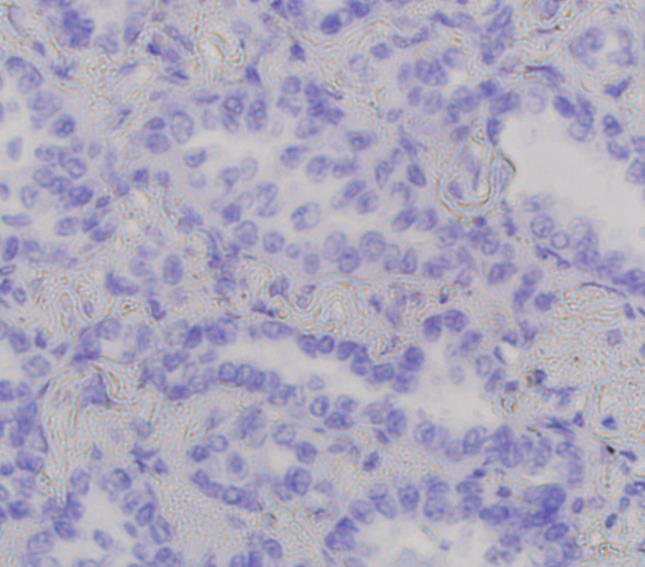 (IHC) staining on 97 lung