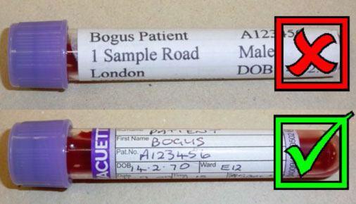 Blood sample Positive ID check- surname/forename/dob Confirm with ID wrist band and request form Group and Save vs Cross Match Write