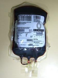 Check blood unit label expiry date / number and blood group Check the blood bag