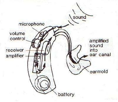 Behind-the-ear Hearing Aids Connected via earhook and tubing to earmold Earmold
