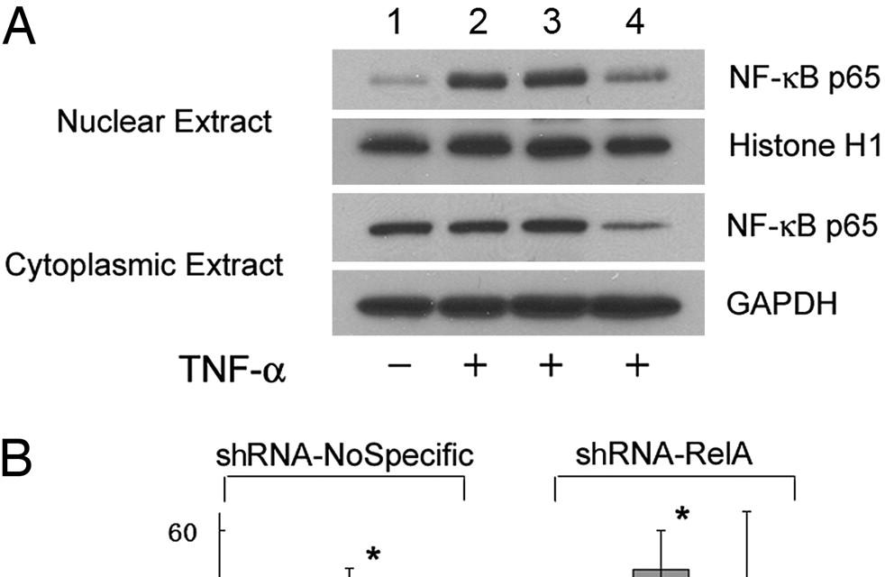 RNA interference assays confirm that TNF-α inhibits asbestos induced cytotoxicity by means of a NF-κB