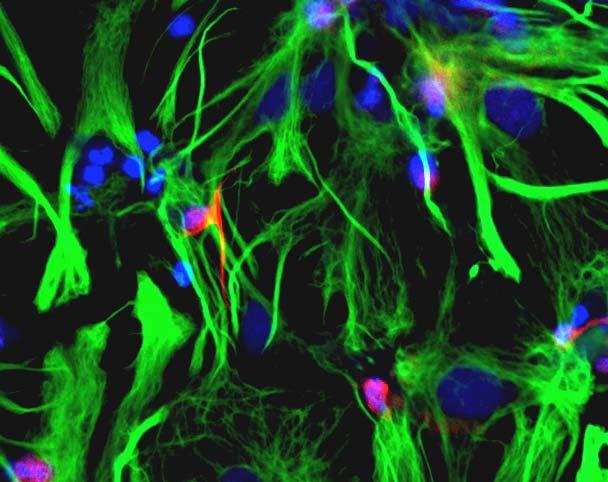 A Toxicity in Cortical Neuronal-Glial Cultures MAP2