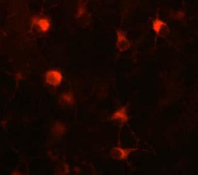 Microglial-derived PRGN