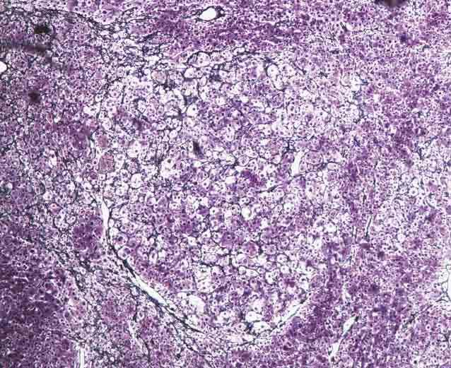 Histological findings of the liver in tg5 flox/flox