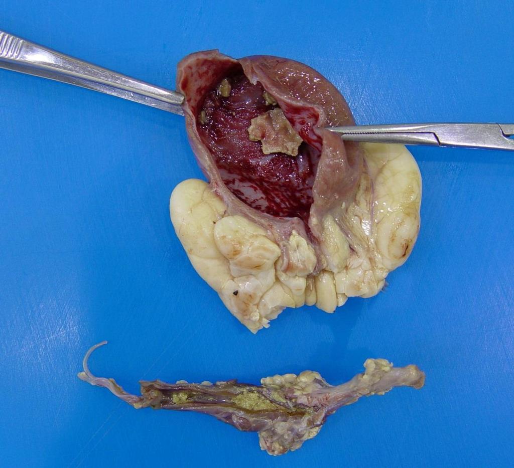 Inflammation Case 6 Bladder and penis from a 2 year