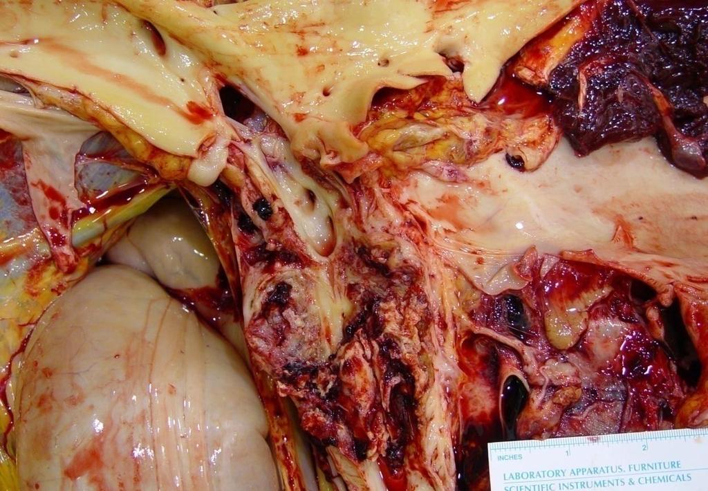 Inflammation Case 8 Aorta Cranial mesenteric artery Cranial