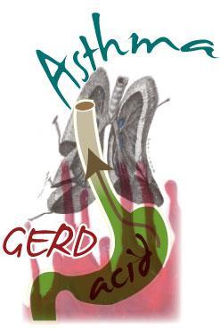 COMORBIDITIES DUE TO DIFFERENT MECHANISMS: 1. Common diseases: 1.1. Gastroesophageal reflux disease (GERD) Prevalence of GERD in general population is 10-20% in western countries.