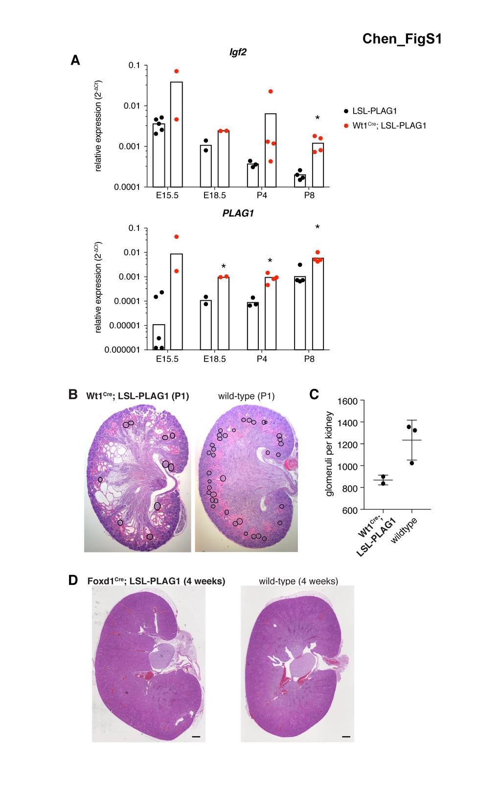 Supplemental Figure S1. PLAG1 kidneys contain fewer glomeruli (A) Quantitative PCR for Igf2 and PLAG1 in whole kidneys taken from mice at E15.5, E18.5, P4, and P8.