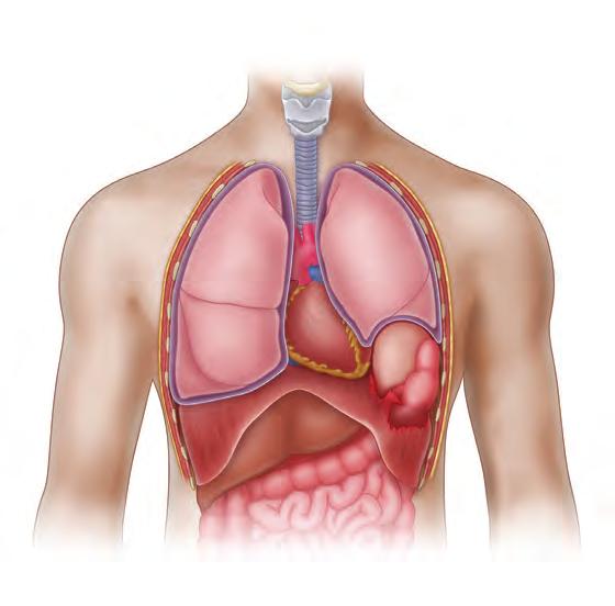 SECONDARY SURVEY 77 Lung Displaced mediastinum Ab