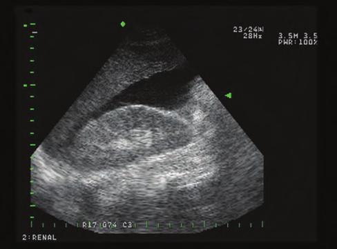ASSESSMENT AND MANAGEMENT 91 n FIGURE 5-4 Focused Assessment with Sonography for Trauma (FAST). In FAST, ultrasound technology is used to detect the presence of hemoperitoneum.