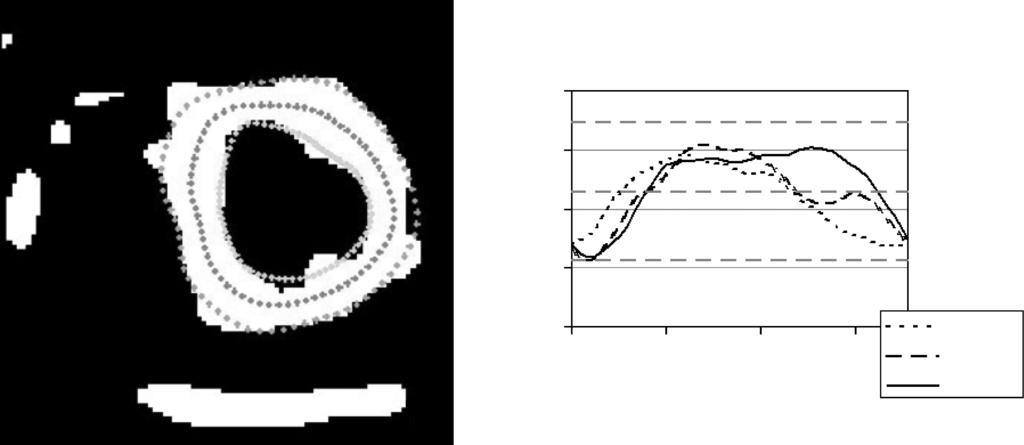 696 steady-state leads to an alternating tag-line intensity in the final CSPAMM image. To avoid this effect, a dummy RRinterval was introduced in the measurement (i.e., the first image acquired in a transient state of magnetization is subsequently rejected.