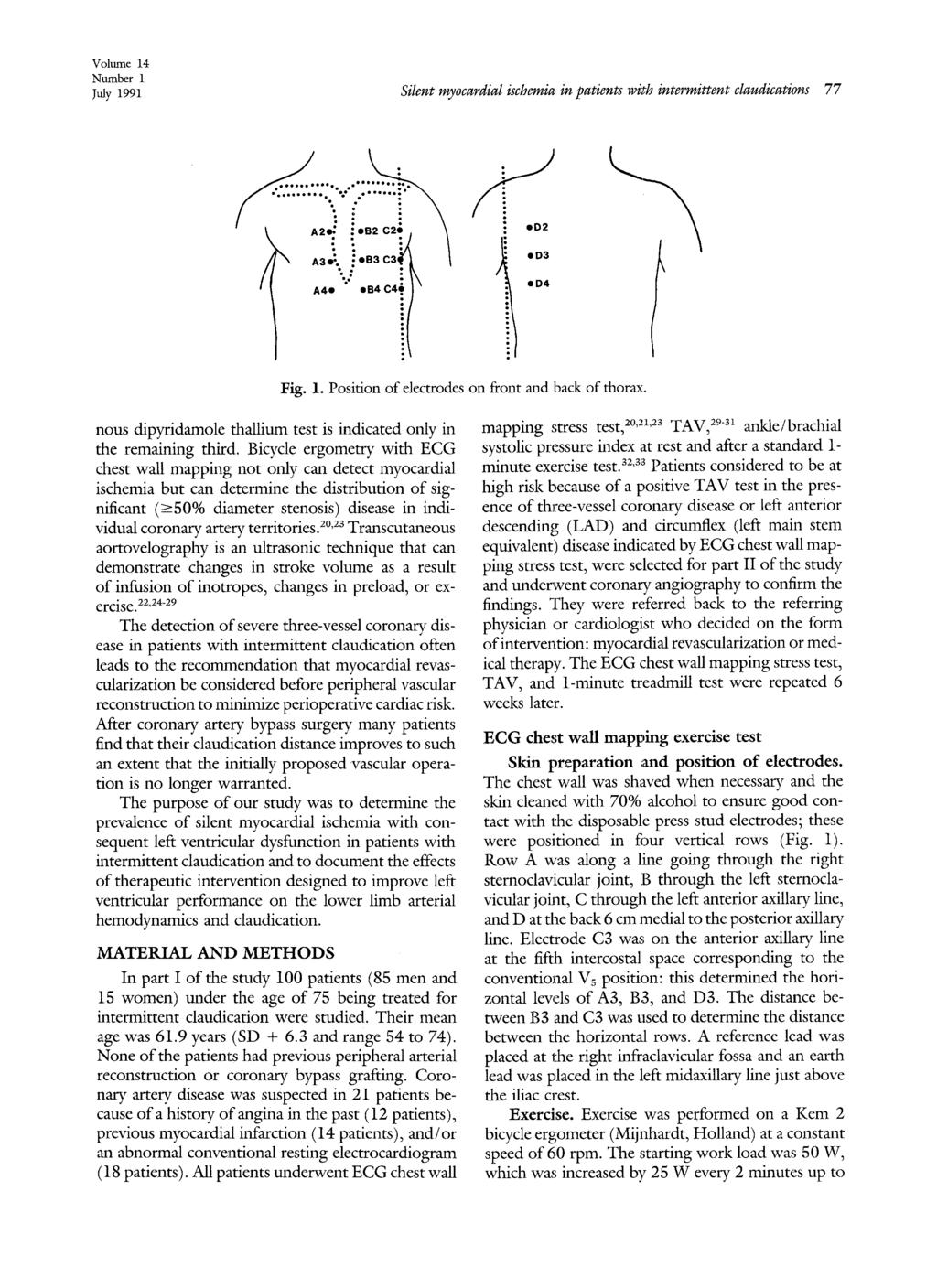Volume 14 Number 1 3~y 1991 Silent myocardial ischemia in patients with intermittent claudications 77 ::::::::::::::::::::::....4!i, I ed2 ed3 ed4 Fig. 1. Position of electrodes on front and back of thorax.