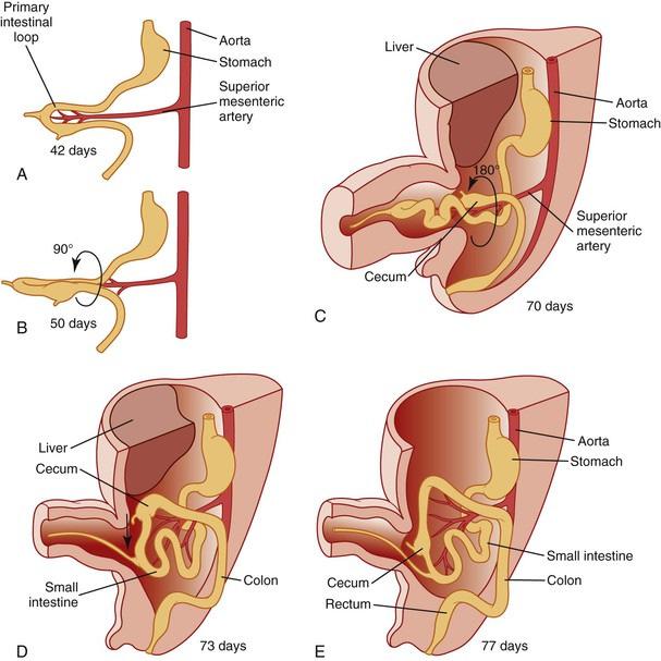 Hong Kong: Churchill Livingstone; 1997:241.) At the end of the 6 th week GA, the intestinal loop herniates through the umbilicus and rotates 90 degrees counterclockwise around the SMA(A,B).