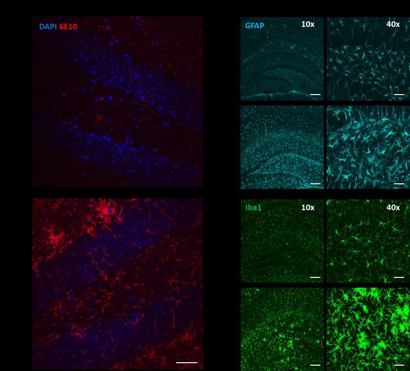 9 Figure 1. Aβ deposition and reactive gliosis in 5xFAD mice.