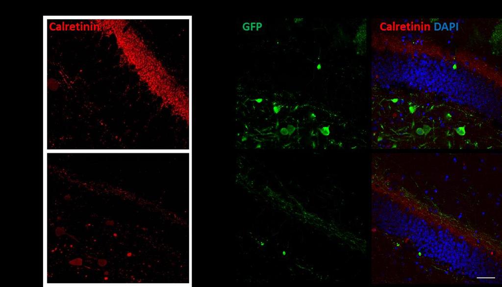 11 Figure 2. Calretinin + nerve terminal deficit in 5xFAD mice and mossy cell innervation to contralateral IML.