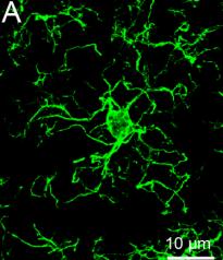Microglia in pathological conditions Beneficial