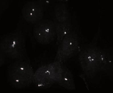(c) Immunofluorescence images show that EB1 depletion does not affect localization at spindle poles of HeLa cells