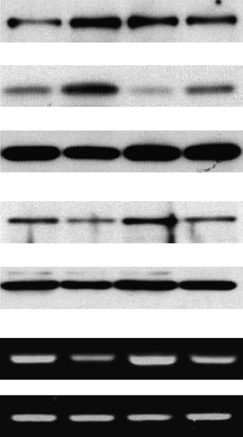 The sequence alignment of PRE within the IKKa promoter is shown (green letter: core DNA motifs of PRE, black bar: region amplified in CHIP-PCR).
