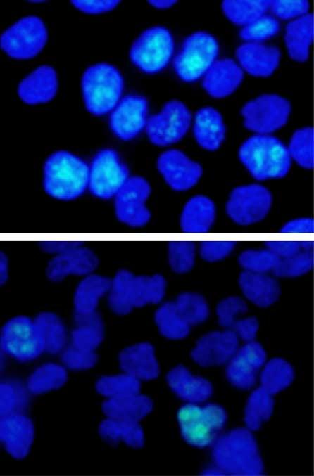 (c,d) CNE cells were treated with (3 mm) or control (DMSO) and subjected to immunofluorescence staining