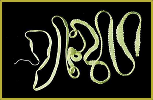 Cestodes (tapeworms) Long, ribbon-like, segmented worms. Primarily intestinal parasites. Can reach 15 m in length.