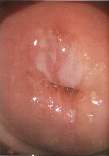 Colposcopy-Cervical Pathology, 1998.