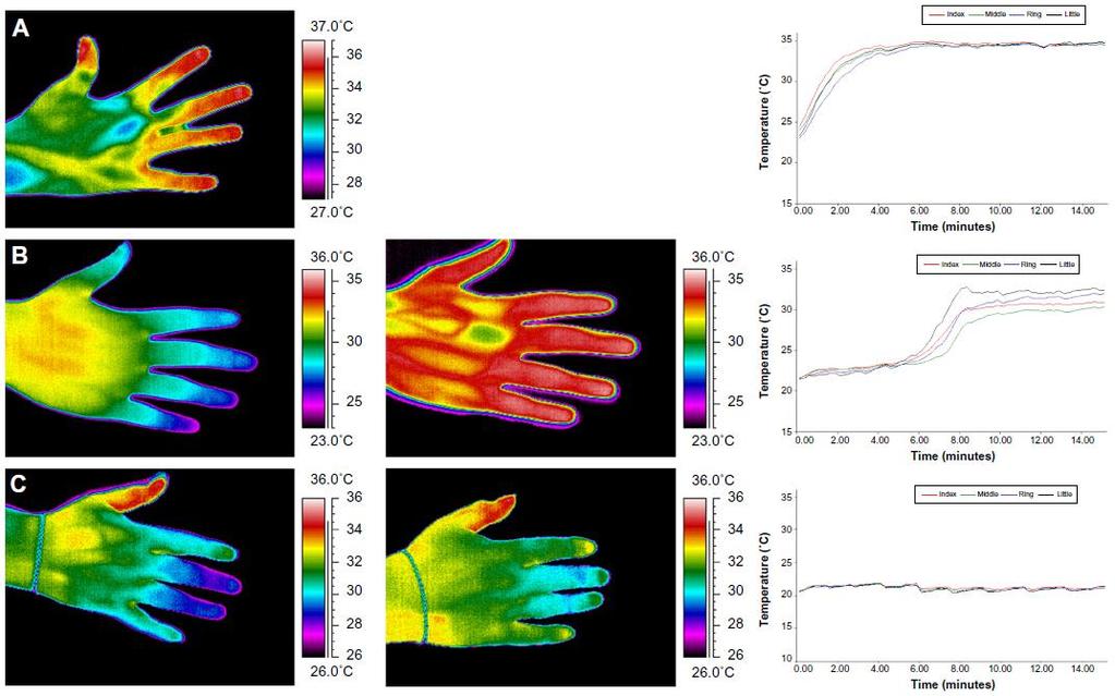 Thermography -