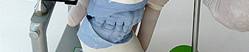 8, where the upper and lower casts are mounted on the MCD, the CO wax is in place. Figure 8.