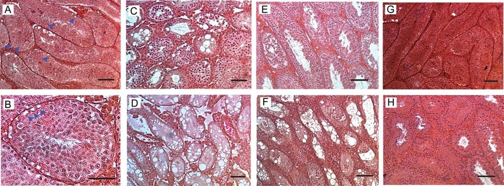 Stem cell recovery reflects male fertility restoration 49 Figure 5 The structural recovery of the seminiferous epithelium after busulfan treatment as determined in histology.