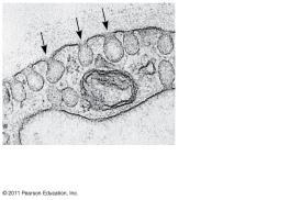 amoeba engulfing a bacterium via phagocytosis (TEM).