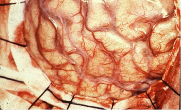 lateral postcentral gyrus. The active cortex got redder when blood flow increased.