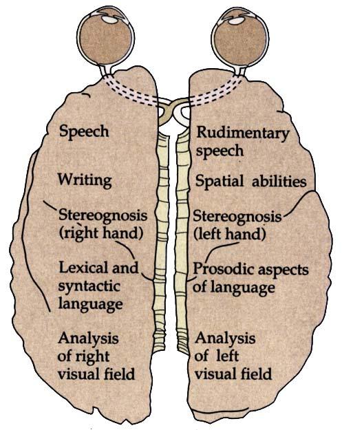 areas with different speech related activities.