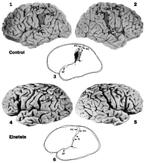 anterior position, associated with no parietal operculum. In this same region, Einstein s brain was 15% wider than controls.