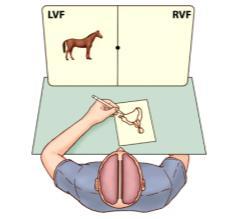 right hemisphere instructs the left hand to draw a saddle. 28 Projection Areas 1.