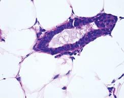 Deletion of does not Disrupt Pubertal Mammary Gland