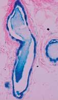 (B) Primary mammary epithelial cells from MMTV-Cre;