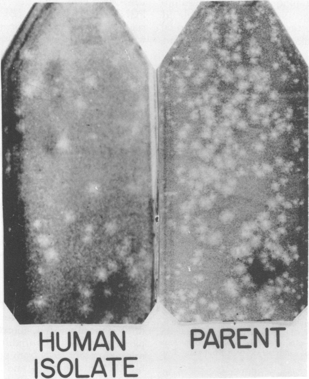 VOL. 14, 1976 TEMPERATURE-SENSITIVE DENGUE- VIRUS 13 HUMAN PARENT ISOLATE FIG. 1. Original DEN- human isolate and passage 6, parent virus, plaqued in LLC-MK cells.