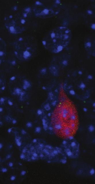 At left, the distance etween the centrosome and the center of nucleus in control adult-orn DGCs at 5, 14, 21 and 28 dpi, showing the transient migration of centrosomes away