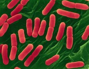 E.coli Rod shaped cells, usually 2 nanometers in length Prokaryotic Gram-negative Found in the intestines of