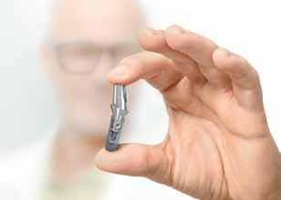Not all implants are created equal Your dentist trusts Straumann dental implants because they are not willing to compromise on the products they select for patient care.