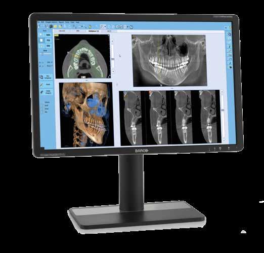 20 21 NNT. TECHNOLOGICAL HEART. Technologically advanced software for 2D and 3D imaging.