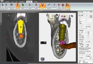 and trace the inferior alveolar nerve, making treatment planning safer and more precise.
