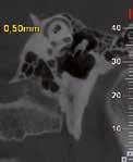 temporomandibular joints, maxillary