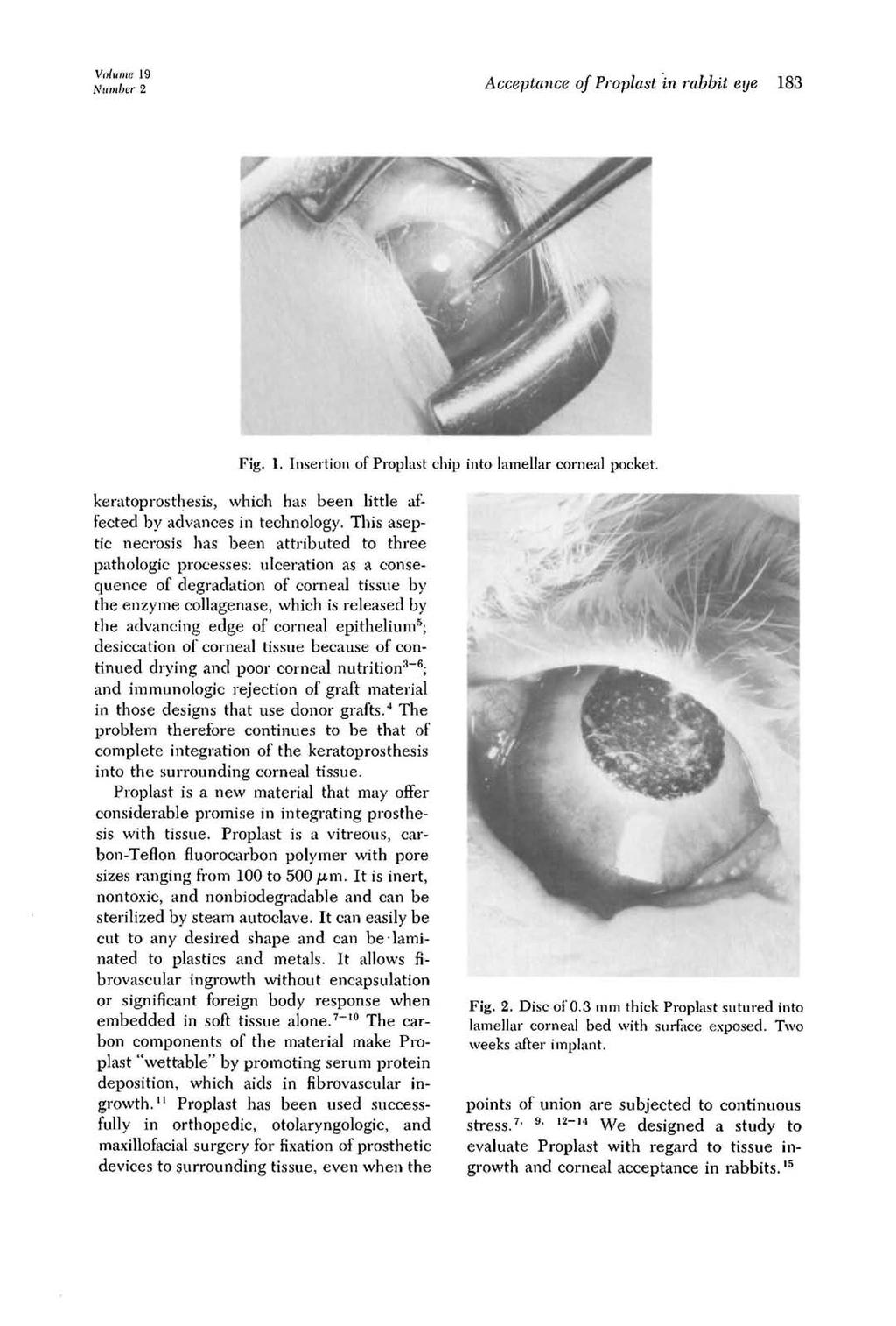 Volume, 19 Number 2 Acceptance of Proplast in rabbit eye 183 Fig. I, Insertion of Proplast chip into lamellar corneal pocket.