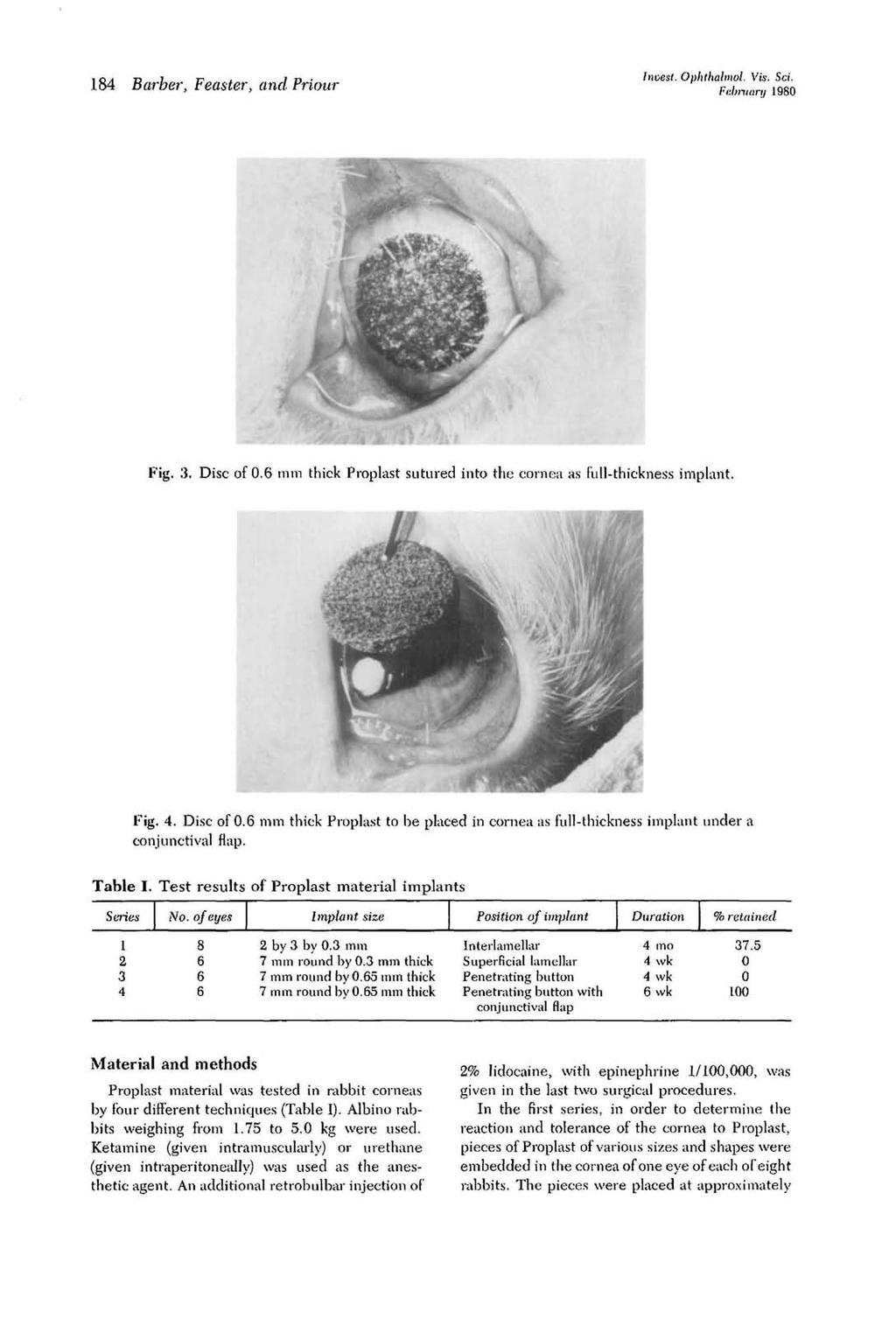 184 Barber, Feasier, and Priour Invest. Ophthalmol, Vis, Sci. February 1980 Fig. 3. Disc of 0.6 mm thick Proplast sutured into the cornea as full-thickness implant. Fig. 4. Disc of 0.6 mm thick Proplast to be placed in cornea as full-thickness implant under a conjunctival flap.